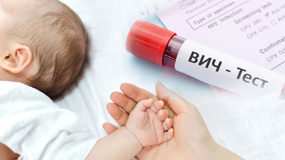 Исследование по профилактики ВИЧ у младенца